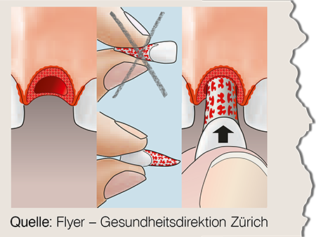 Quelle: Flyer – Gesundheitsdirektion Zürich